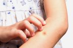 مشاهده پشه آئدس در آذربایجان‌شرقی